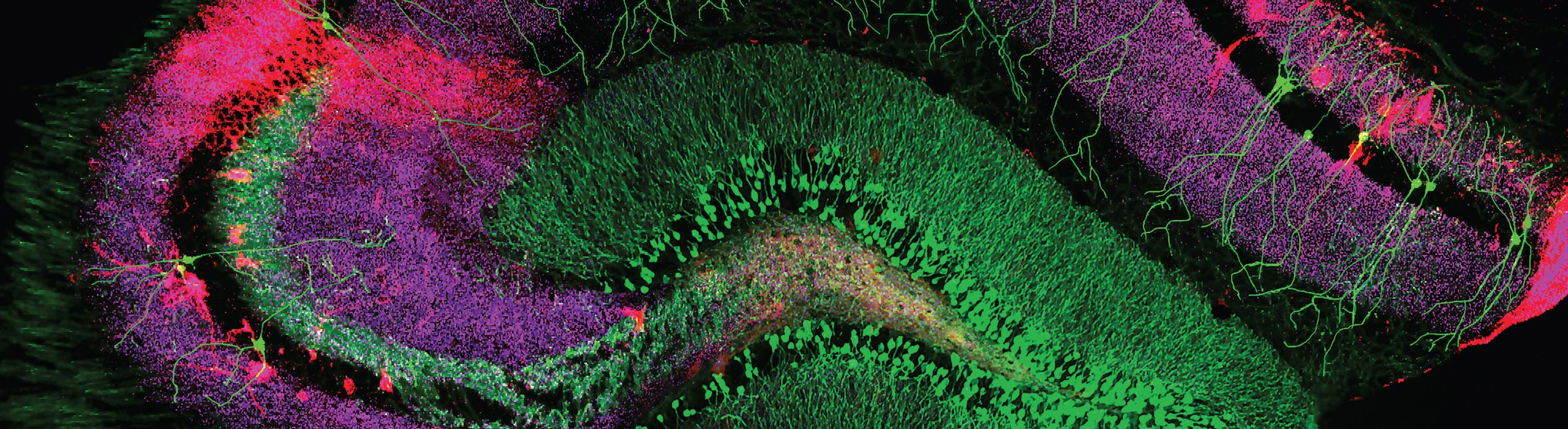 Home - CAS - Undergraduate Neuroscience Program | UAB