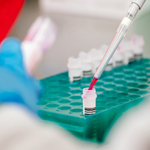 UAB-UCSD O'Brien Center for Acute Kidney Injury Research