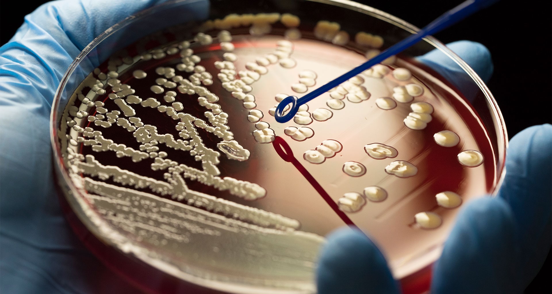 phd in medical microbiology in usa