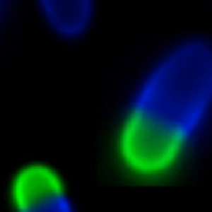 Microbial Pathogenesis