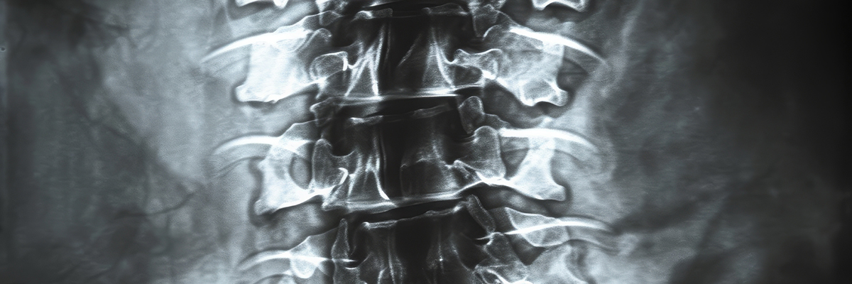 This black and white photograph depicts a detailed close-up of the back of a skeleton, showcasing the intricate structure of the bones, X-ray film of the entire spinal column, AI Generated