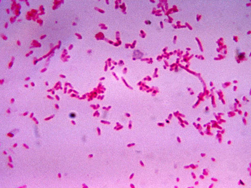Streptococcal Pharyngitis Bacteria Shape