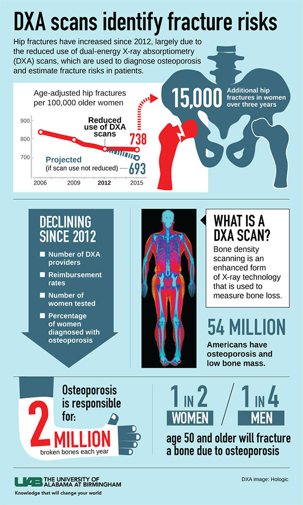 DEXA scan for diagnosing osteoporosis