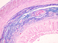 Key role found for gut epithelial cells and their expression of MHCII in the defense against deadly diarrheal infections