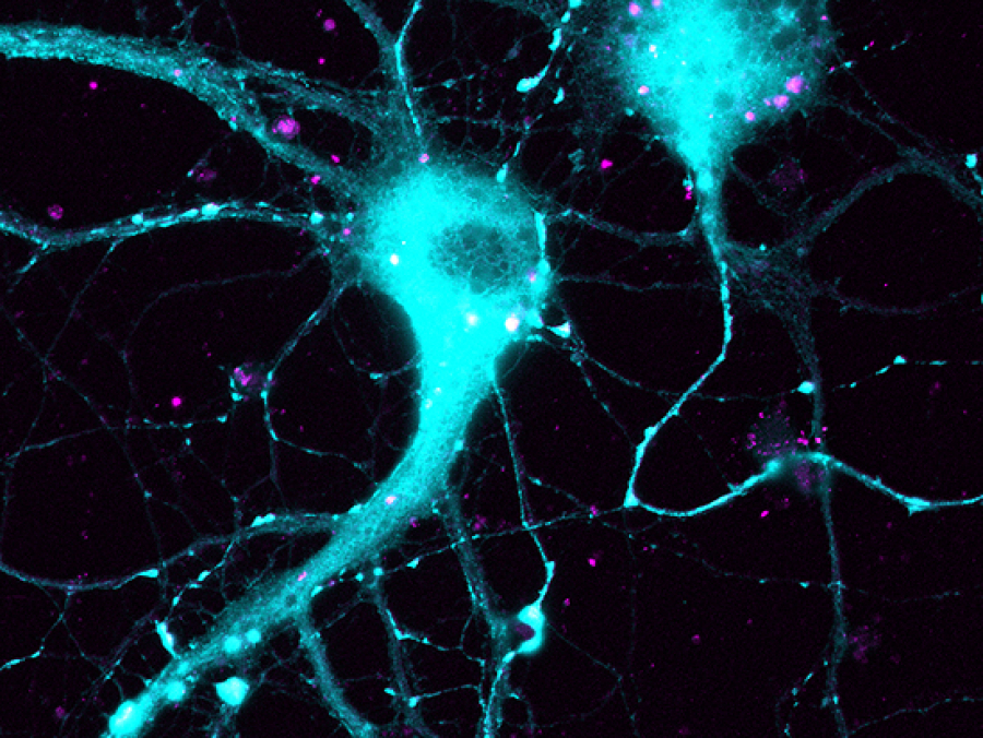 Taurine and oxidative stress in retinal health and disease - Castelli -  2021 - CNS Neuroscience & Therapeutics - Wiley Online Library