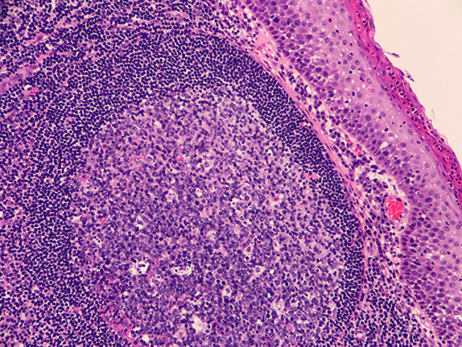 A fate determination fork-in-the-road for germinal center Tfh and T ...