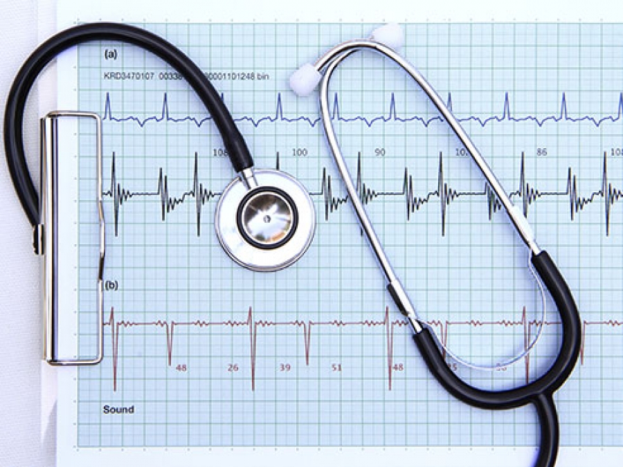 New REGARDS data show heart attack, stroke risk equations are accurate ...