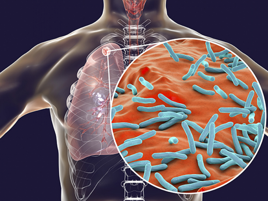 mycobacterium tuberculosis labelled diagram