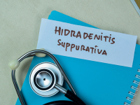 Study reveals the disruption of interaction between proteins CD2:CD58 is a potential new treatment option for people with hidradenitis suppurativa