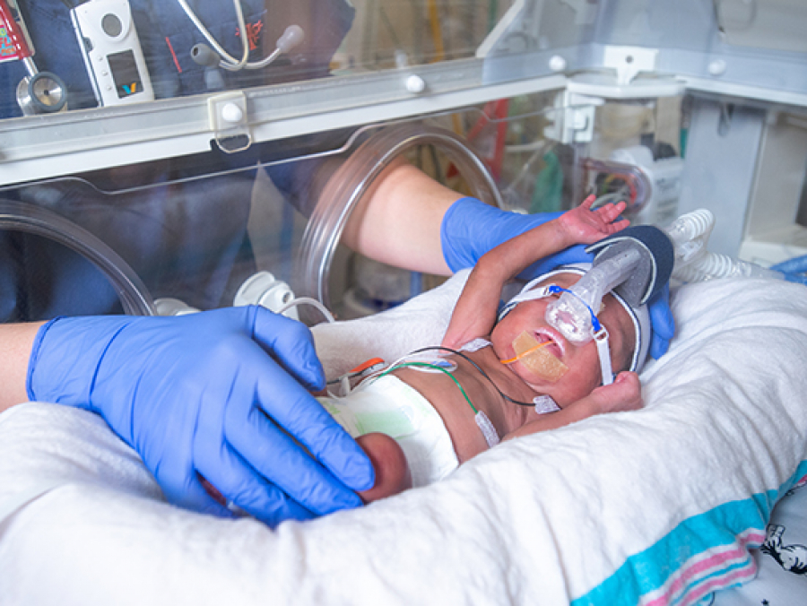 Higher-volume Feedings Help Postnatal Growth In Preterm Infants - News ...