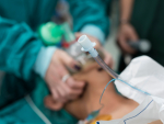 UAB to participate in trial to find best sedative choice for intubations