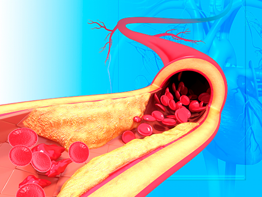 Lim awarded NIH grant to study role of vascular smooth muscle cells in ...