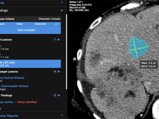 Medical Imaging Platform with AI