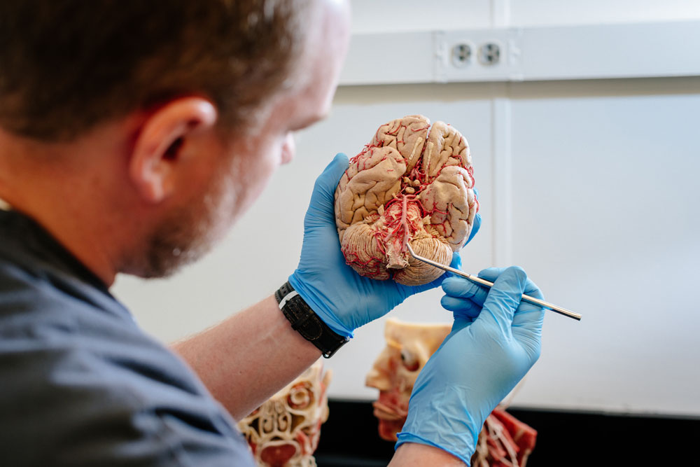 rep anatomy brain 1000px
