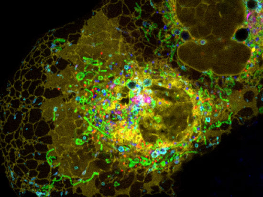 This glow-in-the-dark Trojan horse makes cancer cells build their own ...