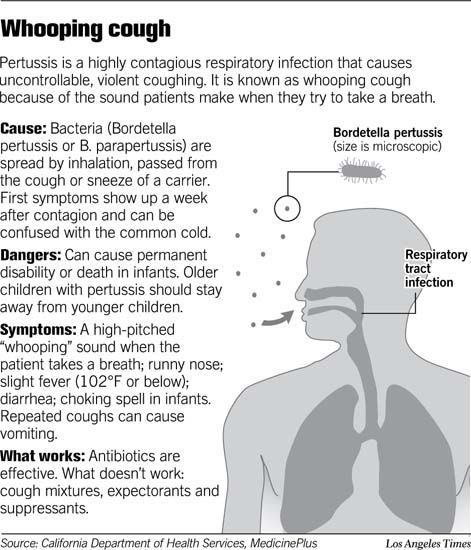 News Whooping Cough Students Health